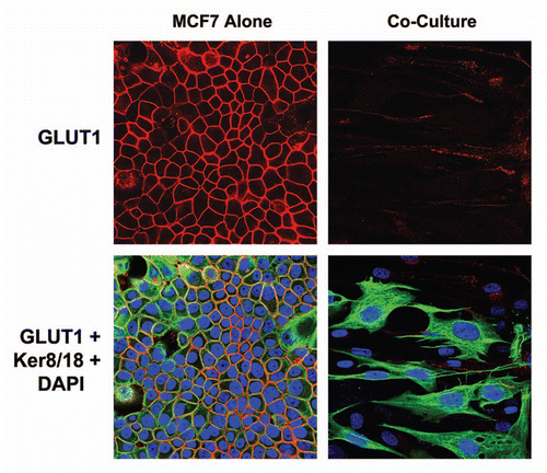 Figure 10 GLUT1 expression in MCF7 cells is downregulated by co-culture with stromal fibroblasts. MCF7 cell-fibroblast co-cultures were immuno-stained with a specific antibody probe directed against GLUT1. MCF7 cells cultured alone were processed in parallel, under identical culture conditions. Note that GLUT1 expression is dramatically downregulated when MCF7 cells are co-cultured with fibroblasts, consistent with our functional results obtained by FACS analysis. MCF7 cells were visualized by immuno-staining with keratin-8/18 antibodies. Nuclei are counter-stained with DAPI and appear blue.
