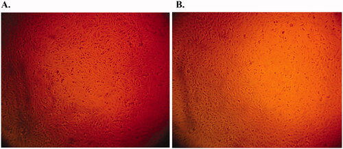 Figure 5. Cytotoxicity testing of F3. Photomicrograph showing the viability of HSF cells cultured in direct contact with a CS/DHO gel prepared with 1.8% CS and 2% DHO at a HPL concentration of: (A) 0 μg/mL and (B) 100 μg/mL.