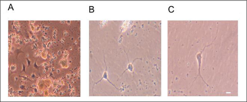 Figure 4. Purity of neuronal cell culture depends on effective protease treatment.Images are dispersed striatal cells after 5 days in culture when cells were isolated using the described methodology: (A) without the use of papain before plating; (B) with 5 min of papain treatment before plating; or (C) after two 10-min papain treatments before plating. Scale bar indicates 20 µm. Cell images were taken by a digital camera mounted on a Nikon TMS-12807 microscope with a 20× lens.