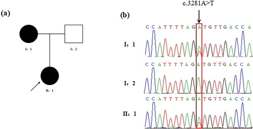 Figure 1. Identification of the missense variant of LAMC1 in the POI family. (a) Pedigree of the family with POI. Filled black symbols represent affected members. Arrow denotes the proband. (b) The chromatogram of the missense variant c.3281A > T (p.D1094V) of LAMC1 in the patient and his parents. The arrow denotes the variant site.