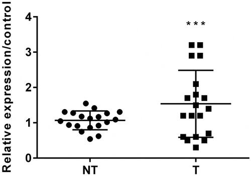 Figure 1. Circular RNA circZNF609 (circZNF609) was higher expressed in prostatic cancer (PC) tissues. (NT: non tumour, T: tumour). The level of circZNF609 was conspicuously higher expressed in PC tissues. (***p < .001).