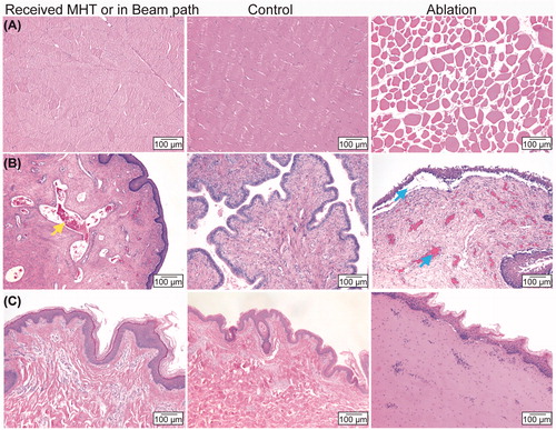 Figure 6. Representative H&E images of analyzed tissues. Columns left-to-right are tissues which received HT and/or were within ultrasound beam path, controls, and ablation targets. Rows show samples from different tissue sites: (A) muscle adjacent to the ventral wall of the urinary bladder (MVB), (B), uterus, and (C) skin and subcutaneous tissue. Yellow arrow shows congestion of the vasculature. Blue arrows show edema and the separation of the lamina propria from the epithelium.