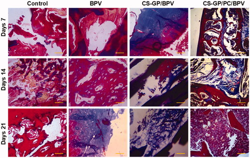 Figure 13. Histopathological evaluation of the anti-inflammatory effects of BPV-loaded CS-GP hydrogel and CS-GP/PC polymeric hydrogel on 7, 14, and 21 days were stained with Masson’s trichrome stain (MTS) (scale bar = 100 μm).