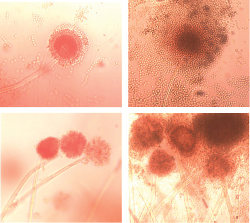 Figure 11. Microscopic views (x100) of Aspergillus flavus conidiophores isolated from flax shives samples.