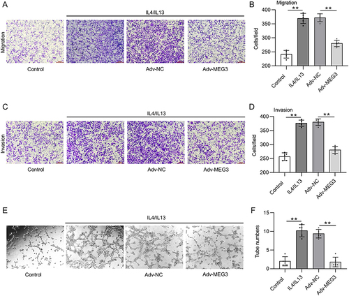 Figure 6 Upregulation of lncRNA MEG3 suppresses cell metastasis and angiogenesis by inhibiting macrophage M2 polarization. Conditioned medium from BMDMs was used to culture Huh-7 cells for 24 h. (A–D) Cell migration and invasiveness in control group, IL4/IL13 group, IL4/IL13 + Adv-NC group, and IL4/IL13 + Adv-MEG3 group were measured by Transwell assays. (E and F) Tube formation assays were conducted to evaluate angiogenesis in indicated groups, and formed tubes were quantified. **p<0.01.