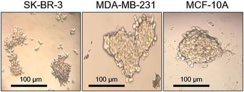 Figure 2 Optical microscope images showing different cell lines growing as non-adherent mammospheres after 7 days of cultivation. Images were analyzed with ImageJ software (NIH).