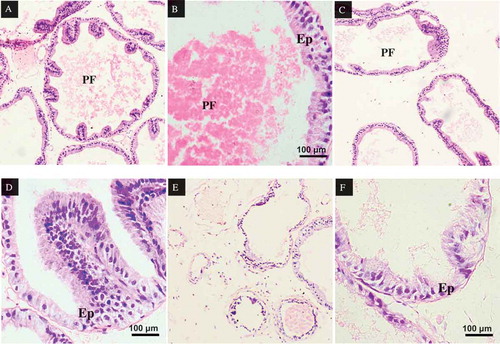 Figure 7. Prostate cross-sections of rats, stained in H&E. (A) Prostate gland of rats in control group, X100. The lumen contains prostatic fluid (PF). The glandular epithelium (Ep) are lined with simple to pseudostratified to columnar epithelium. (B) Prostate gland of rats in control group, X400. The lumen contains prostatic fluid (PF) and the glandular epithelium (Ep) are lined with simple to pseudostratified to columnar epithelium cells. (C) Prostate gland of rats in MSG60 group, X100. Atrophy of the prostate lumen compared to control group was observed. (D) Prostate gland of rats in MSG60 group, X400. No changes in the glandular epithelium cells (E) as the cells are still in intact. (E) Prostate gland of rats in MSG120 group, X100. Prostatic fluid in the lumen of the prostate gland is greatly reduced in MSG120 group compared to MSG 60 and control groups. (F) Prostate gland of rats in MSG120 group, X400. Epithelium of prostate in MSG120 rats appear thinner and less folded when compared with the MSG60 and control groups.
