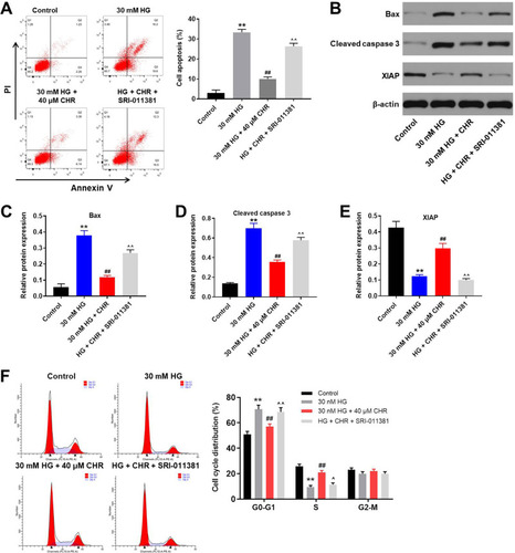 Figure 4 TGF-β activator reversed the therapeutic effect of CHR on HG-treated AB8/13 cells in vitro. (A) AB8/13 cells were treated with 30 mM HG, 30 mM HG + 40 μM CHR or 30 mM HG + 40 μM CHR + 10 ng/mL SRI-011381. The apoptosis of AB8/13 cells was detected by flow cytometry. (B) The protein expressions of Bax, XIAP and cleaved caspase 3 in podocytes were measured by Western blot. (C) The relative protein expression of Bax was quantified by normalizing to β-actin. (D) The relative expression of cleaved caspase 3 was quantified by normalizing to β-actin. (E) The relative expression of XIAP was quantified by normalizing to β-actin. (F) Cell cycle distribution was tested by flow cytometry. **P < 0.01 compared to control. ##P < 0.01 compared to 30 mM HG. ^P < 0.05, ^^P < 0.01 compared to 30 mM HG + 40 μM CHR.