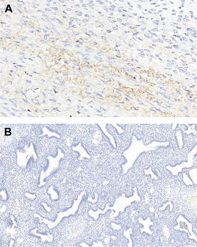 Figure S6 Immunohistochemical analysis showing nearly absence of MMP-2 and -9 expression in all groups.