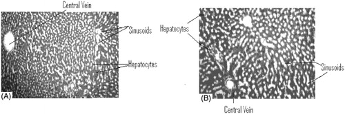 Figure 2. (A) Liver section of rat treated with xanthotoxin. (B) Liver section of rat treated with umbelliferone.