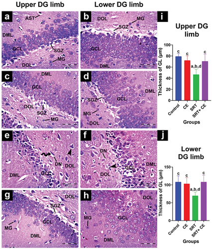 Figure 8. Impact of sertraline (SRT) and Cyperus esculentus extract (CEE) on hippocampus dentate gyrus (DG) upper and lower limb. (a-d) control and CEE-treated rats sections display DG limbs with an organized granular cell layer (GCL) containing normal granule cells with small rounded nuclei separated from the hilus by a narrow sub-granular zone (SGZ). The dentate molecular layer (DML) and dentate pleomorphic layer (DOL) contain microglial cells (MG) and astrocytes (AST). (e-f) SRT-treated rats sections display a thin GCL with numerous degenerative neurons (DN) characterized by shrunken, darkly stained nuclei surrounded by clear pericellular holes (curved arrow) and clumped microglial cells (head arrow). SGZ is absent. (g-h) SRT-CEE treated rat’s sections show an apparently normal GCL with normal neurons and an evident SGZ area in the upper DG limb only. (H&E, A-H × 400) (i&j) mean granular cell layer of DG limbs thickness. Bars (mean ± SD) labeled with different letters indicate significant differences: asignificant variation with the control group, bwith the CEE group, cwith the SRT group, and dwith the SRT+CEE group.