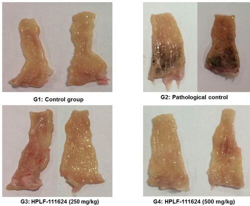 Figure 7 Representative gross morphology rectum picture showed the protective effect of HPLF-111624 in acetic acid-induced ulcerative proctitis animals.
