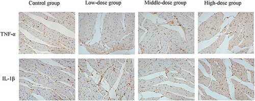 Figure 11 Expression of TNF-α and IL-1β detected via immunohistochemistry in the heart sections at 120h (magnification ×400). The positive color was tan.