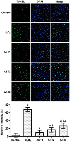 Figure 4. Effect of AST on the apoptotic staining of ARPE-19 cells induced by H2O2. Note: TUNEL assay was used to investigate the apoptosis of the cells. Apoptotic cells are shown in green colour under the inverted fluorescence microscope (×200). Then, the images of cells stained by TUNEL assay and DAPI were merged, and the intensity was quantified and expressed as histograms. #, p < 0.05 compared with control; *, p < 0.05 compared with H2O2 model group; $, p < 0.05 compared with AST1 group; &, p < 0.05 compared with AST2 group.