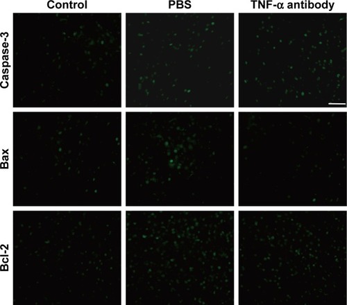 Figure 4 Immunohistochemistry showing the changes of caspase-3, bax and bcl-2 in the hypothalamus 48 h after SAH.