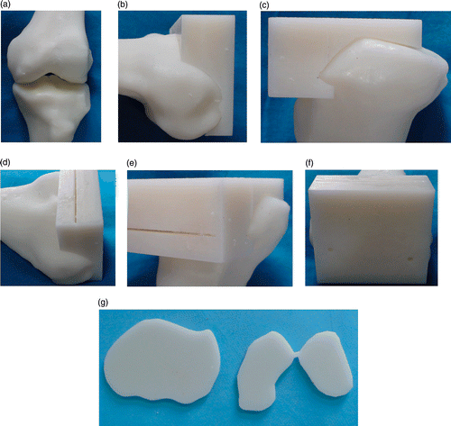 Figure 5. The accuracy of the navigational template was examined by visual inspection. (a) RP model of the femoral condyle and tibial plateau. (b) and (c) The navigational template fits the RP model of the knee perfectly. (d) and (e) The gap for the osteotomy in the navigational template. (f) The rotational alignment for the femur defined by the two drill guides. (g) RP model of the distal femur and proximal tibia surfaces after osteotomy in the actual physical setting.