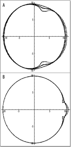 Figure 8 The actual shape of the tail depends on the location of the forces inside the caudal pole (the distance to the center of the blastodisc), and on the size of the segment which exerts the force. In (A), the force is located at 2/10 of R, in the caudal half, in this case, the tail part is almost as big as the head part. In (B), the force is located closer to the caudal pole, by 8/10 of R, the “flow” generates only a little tail.