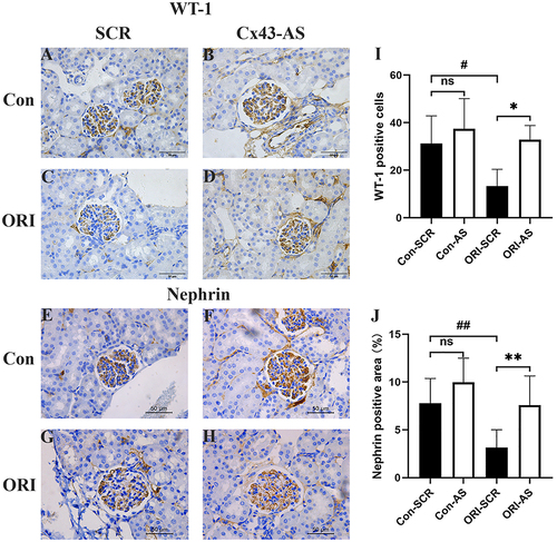 Figure 5 The effect of Cx43 AS on the podocyte injury of ORI mice. (A–D) Representative image of kidney section stained with IHC for WT-1. Standard bar = 50µm. (I) The effect of Cx43 AS on the WT-1 positive cells in glomeruli. (E–H) Representative image of kidney section stained with IHC for Nephrin. Standard bar = 50µm. (J) The percentage of Nephrin positive area stained with IHC. All data represent mean ± SEM (n=12 per group), and one-way ANOVA with LSD-t multiple comparison test was performed; n.s. not significant, #P< 0.05, ##P< 0.01, Con-SCR vs ORG- SCR., *P < 0.05, **P < 0.01, ORI-SCR vs ORI-AS or Con-SCR vs Con-AS.