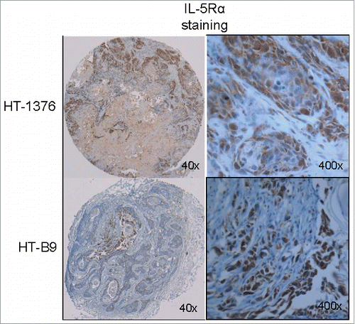 Figure 3. In vivo model of human IL-5Rα-positive MIBC. IL-5Rα staining by IHC on HT-1376 and HT-B9 heterotopic xenografts grown in NOD/SCID mice. Staining of xenografts was processed in identical fashion to human tumor specimens.