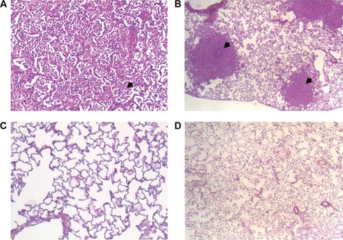 Figure 4 Histological pictures.