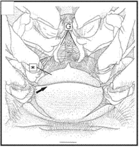 Figure 3. Thelycum drawing of X. kroyeri. Transversal ridge (arrow); gonopore (G); hood (*). Scale bar = 1 mm. (Modified from Pérez-Farfante and Kensley Citation1997).