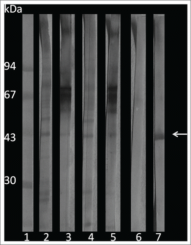 Figure 9. Western blot of G. mellonella infected with P. brasiliensis or P. lutzii. 1) molecular weight marker; 2) P. lutzii; 3) G. mellonella infected with P. lutzii; 4) P. brasiliensis; 5) G. mellonella infected with P. brasiliensis; 6) G. mellonella extract infection; and 7) purified gp43. The arrow indicates the gp43.