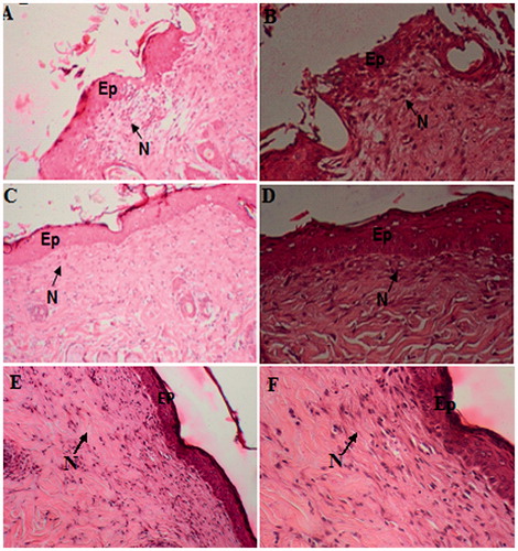 Figure 4. Histologic features of skin sections from burned area stained with hematoxyline–eosin after 8 d of burn induction; (A) untreated wound Gr 100; (B) Untreated wound Gr 200 with thickened and immature epidermis with debridement crust overlying the area of the wound; (C) reference drug ‘CYTOL BASIC’ treated wound Gr 100; (D) reference drug ‘CYTOL BASIC’ treated wound Gr 200 with reduced inflammation and enhanced wound contraction; (E) PLFO-treated wound Gr 100; (F) PLFO-treated wound Gr 200 with intact epidermis, re-epithelialization, regeneration of granulation tissue, angiogenesis and collagen deposition were detected in the treated wounds. Ep: epidermis; N: inflammatory nucleus.