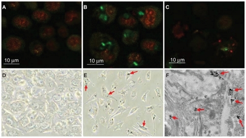Figure 3 Selective nanophotothermolysis of HepG2 cells. A) Confocal image of human hepatocytes incubated for 30 min with 5 mg/L FITC–HSA–MWCNTs. (The nucleus was stained with DRAQ5-red.) B) Confocal detection of MWCNT–HSA–FITC (green) selectively internalized into HepG2 cells (exposed for 30 min to 5 mg/L of FITC–HSA– MWCNTs). C) HepG2 cells were irradiated for 2 min using a 2-W, 808-nm laser beam. Image of cell lysate and aggregated cells after internalization of MWCNT–HSA–FITC and laser radiation. D) CRL-4020 cells incubated for 30 min with 5 mg/L FITC–HSA–MWCNTs visualized by phase contrast microscopy (×400 magnification). E) HepG2 cells incubated for 30 min with 5 mg/L FITC–HSA–MWCNTs visualized by phase contrast microscopy (×400 magnification). F) Transmission electron microphotograph showing clusters of MWCNTs surrounded by plasmalemmal vesicles, confirming the presence of nanomaterial inside the cell (×24,000 magnification).Abbreviations: FITC, fluorescein isothiocyanate; HSA, human serum albumin; MWCNTs, multiwalled carbon nanotubes.