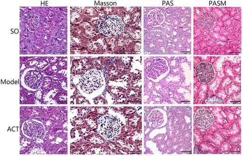Figure 8 ACT attenuated renal histological damage in the DKD rats. Microstructural images of representative renal tissues stained by HE, Masson, PAS and PASM (400× magnification) (scale bar = 50μm).