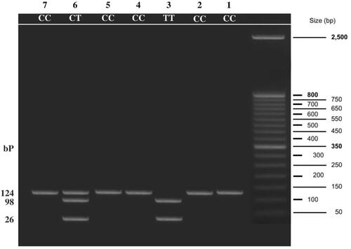 Figure 2 Agarose gel electrophoresis showing TLR-4 (Thr399Ile) genotyping by PCR -RFLP. Lane 1: wild Thr399Thr (CC) genotype at 124 bp (unrestricted); Lane 3: mutant Ile399Ile (TT) genotype at 98 and 26 bp; Lane 6: mutant Thr399Ile (CT) genotype at 124, 98 and 26 bp.