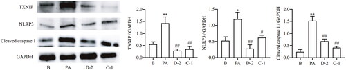 Figure 4. Compounds D-2 and C-1 protected Min6 cells from PA-induced inflammatory injury via TXNIP-NLRP3 signalling. Min6 β cell were incubated with D-2 and C-1 at concentration of 10 μmol/L and then exposed to PA (300 μmol/L) for 12 h. Protein expressions of TXNIP, NLRP3 and cleaved caspase 1 were measured by Western blot. *p < 0.05 & **p < 0.01 vs control cells; #p < 0.05 & ##p < 0.01 vs PA-treated cells. Data were presented as mean ± SD (n = 4).