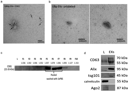 Figure 1. Electron microscopy analysis of exosomes. (a) Exosomes (EXs) purified from UBtip cells, immunogold-labelled for endogenous CD63 (PAG 10nm, arrows), (b) Extracellular vesicles enriched from primary UB cells, unlabelled. All cells were cultured for 24 h before the CM was harvested for exosome purification or vesicle enrichment. (c) Optiprep gradient fractions (F1 to F10; each 1 mL) were tested for CD81 (tetraspanin commonly present on exosomes; 20 µL of each fraction). CD81-positive fractions F5 to F7 were pooled, washed with 1 × PBS and concentrated by filtration to yield the sample analysed in (d). The density (g mL–1) of each fraction is shown under each fraction number. (D) Western blot analysis for Exosomes (exosomes) and total cell lysate (L) (5 µg each). The purified exosome sample showed bands for CD63, Alix and Tsg101, all vesicle markers. These markers could be found in the cell lysate for CD63 and Alix, but not for Tsg 101. Calreticulin and ago2 (markers for cellular contaminants) could be found only in the cell lysate.