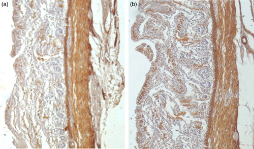 Figure 1. (a and b) Immunohistochemical stains for α-smooth muscle actin at 6 and 14 days respectively; both demonstrating minimal expression within the bulk of the circular and longitudinal muscles. All of the figures are orientated such that the muscular layers are on the right side.