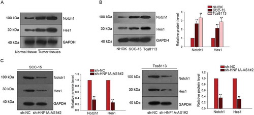 Figure 5. HNF1A-AS1 enhanced the activity of Notch signaling in OSCC cells. A. The protein levels of Notch1 and Hes1 in normal tissue and OSCC tissues were determined by western blot. B. The protein levels of Notch 1 and Hes1 were tested in two OSCC cells (SCC-15 and Tca8113) and NHOK cell. C. F. The protein level of Notch1 and Hes1 was detected in HNF1A-AS1-downregulated OSCC cells. **P < 0.01 vs. control group.