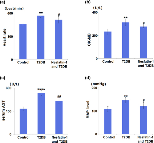 Figure 3. Effects of Nesfatin-1 on heart function in the control and type 2 diabetes (T2DB) mice. (a) Heart rate; (b) Creatine kinase-MB (CK-MB) level; (c) serum aspartate aminotransferase (AST) level; (d) mean arterial pressure (MAP) level (**, ****, P < 0.01, 0.0001 vs. vehicle group; #, ##, P < 0.05, 0.01 vs. streptozotocin (STZ) mice).