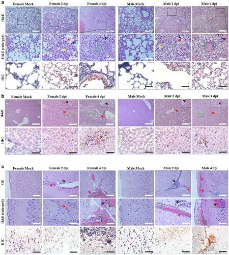 Figure 4. Histological examination of Roborovski SH101 hamster infected with SARS-CoV-2. In section images, green box area is enlarged again and shown at the top right black box. (a) The representative images of the H&E and IHC of the lungs of 2-month-old P. roborovski SH101 at 2 and 4 dpi of SARS-CoV-2. Multifocal interstitial pneumonia with thickened alveolar septa (yellow arrows) and infiltration of fibrin and mononuclear cells (black arrows) are indicated. Hyaline membrane is also observed at 2dpi (red arrows). SARS-CoV-2 antigen expression is colocalized with areas of peribronchial and alveolar epithelial cells as shown in IHC for SARS-CoV-2-nucleocapsid (400 ×). (b) The representative images of the H&E and IHC of the livers of 2-month-old P. roborovski SH101 at 2 and 4 dpi of SARS-CoV-2 showing pathologies. Focal and intraportal lymphoid cell aggregation and multifocal fatty changes are indicated by red and black arrows, respectively. SARS-CoV-2 antigen expression is colocalized in few liver cells as shown in IHC for SARS-CoV-2-nucleocapsid (100 ×). (c) The representative images of the H&E and IHC of the brains of 2-month-old P. roborovski SH101 showing pathologies at 2 and 4 dpi. Subarachnoid hemorrhage and lymphocyte focal infiltration are indicated by red and black arrows, respectively. SARS-CoV-2 antigen expression is colocalized in few subarachnoid as shown in IHC sections for SARS-CoV-2-nucleocapsid (100 ×). The scale bars represent 100 μm for 100 × and 20 μm for 400 × 