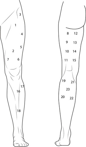 Figure 8 Points of assessment for topographical pressure pain sensitivity maps of the lower extremity.