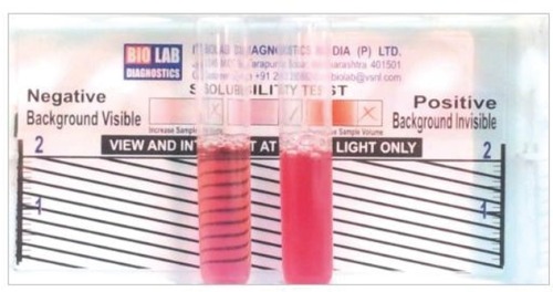 Figure 1 Showing the reactivity pattern of the rapid sickle cell hemoglobin-S (dithionate qualitative solubility) test
