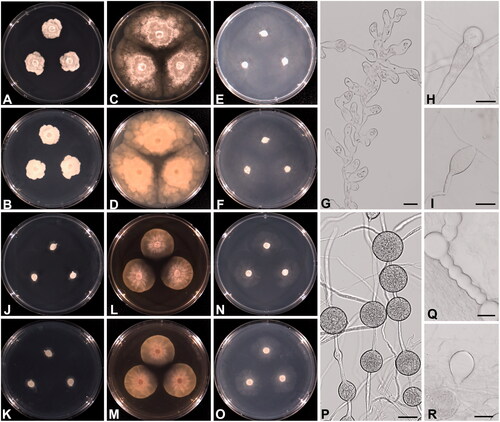 Figure 2. Cultural and morphological characteristics of Phytophthora lagoariana NNIBRFG9322 (W655) (A–I), P. chlamydospora NNIBRFG9321 (W694) (J–R) on PDA (A, B, J, K), V8A (C, D, L, M), and CMA (E, F, N, O) after 72 h at 25 C° (A, C, E, J, L, N: observed view; B, D, F, K, M, O: reverse view). Microscopic structures observed under a light microscope: hyphal swellings (G, H), and sporangium (I) of P. lagoariana; chlamydospores (P, Q), and sporangium (R) of P. chlamydospora. Scale bar = 13.4 μm for G and H, 27 μm for I, P-R.