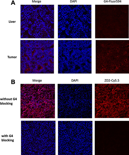 Figure 4 Histology analysis. (A) Immunofluorescence staining of woodchuck frozen sections (upper: liver, lower: tumor) with G4 anti-EDB-FN monoclonal antibody (red). While substantial EDB-FN was stained in the extracellular matrix of the HCC, normal liver was not stained; (B) Specific binding of ZD2 peptide to EDB-FN in woodchuck HCC was observed for strong binding of ZD2-Cy5.5 (red) in tumor tissues while little fluorescence staining was observed for the adjacent woodchuck HCC sections pre-incubated with G4 antibody and followed by ZD2-Cy5.5, indicating blockage of ZD2-Cy5.5 binding by G4 antibody (blocking).