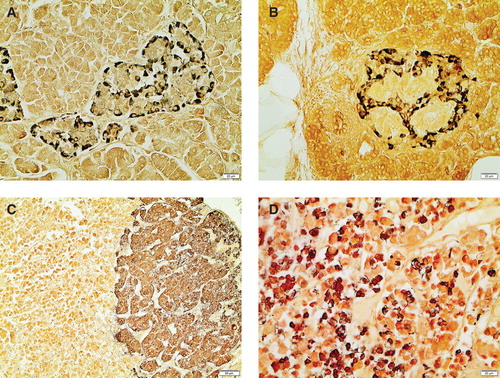 Figure 2. Examples of Grimelius stain, all performed in 1972. A: Normal human islet of Langerhans. B: Human islet of Langerhans with large deposits of amyloid. Most remaining cells are α2 (A) cells. (Patient with type 2 diabetes.) C: Part of adrenal gland. Cells in medulla are argyrophilic, while cortical cells are unlabelled. (Same case as A.) D: Section from anterior pituitary. One population of cells is argyrophilic. (Same case as A).
