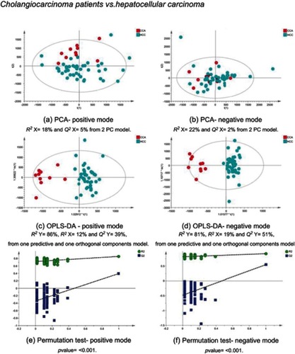 Figure 11 CCA patients vs HCC patients. PCA scores plots for (A) positive and (B) negative ion mode data of CCA patients and HCC patients. OPLS-DA scores plots showing group separation for both (C) positive and (D) negative ion mode data and the corresponding permutation tests for (E) positive and (F) negative ion mode data. Abbreviations: CCA, cholangiocarcinoma; HCC, hepatocellular carcinoma; PCA, principal component analysis; OPLA-DA, orthogonal projections to latent structures discriminant analysis.