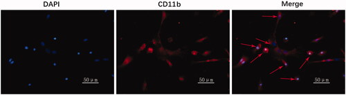 Figure 1. Primary microglia purity was identified by immunofluorescence. Blue signal indicates nuclear staining with DAPI; red signal represents CD11b staining with CY3; arrows represent microglia with typical morphology.