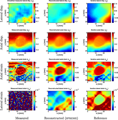 Figure B1. Displacement and strain images for fibroadenoma 1.