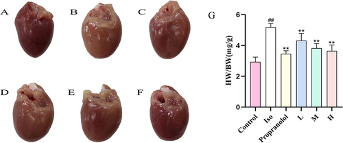 Figure 5 Pretreatment with CRC-CDs improved ISO-induced myocardial ischaemia and reduced relative heart weight in rats. (A) Control group. (B) Iso group. (C) Propranolol group. (D) Low-dose CRC-CDs group. (E) Medium-dose CRC-CDs group. (F) High-dose CRC-CDs group. (G) Heart index of rats in each group. Date are represented as means ± SD (n = 8). ##P < 0.01 compared with the control group, **P < 0.01 compared with the Iso group.