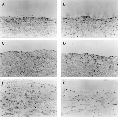 Figure 5. H & E staining of collagen-CS scaffold after fibroblasts implanted for (A) one week, (C) 3 weeks, and (E) 5 weeks. H & E staining of collagen scaffold after fibroblasts implanted for (B) one week, (D) 3 weeks, and (F) 5 weeks. (X250).