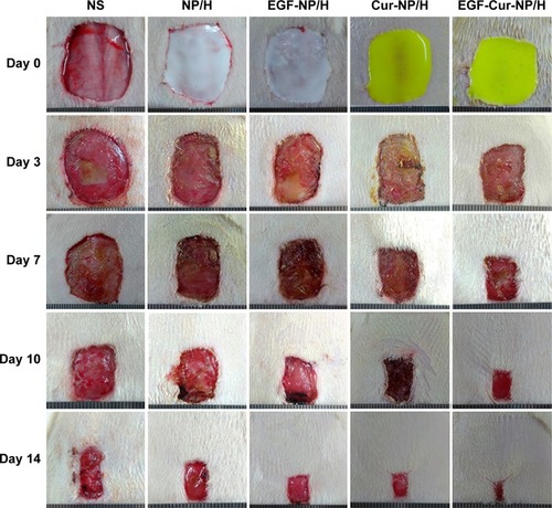 Figure 5 Macroscopic observations of wound closure for NS, NP/H, EGF-NP/H, Cur-NP/H, and EGF-Cur-NP/H treated groups at day 0, 3, 7, 10, and 14 post-wounding.Abbreviations: EGF, epidermal growth factor; NS, normal saline; NP, nanoparticle; H, hydrogel; Cur, curcumin.