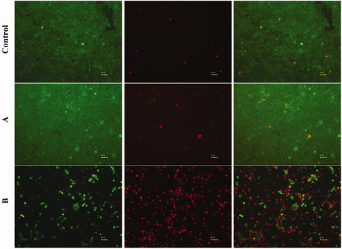 Figure 4. Live and dead cell staining of K1 cells after co-cultured with PBS (Control), FTY720@SF-SeNPs (A), and FTY720@T7-SF-SeNPs (B) for 24 h. Red colour indicates dead cells and green for live cells.