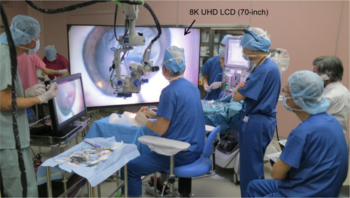 Figure 2 8K UHD microscopic camera for ophthalmic surgery in the operating room site.