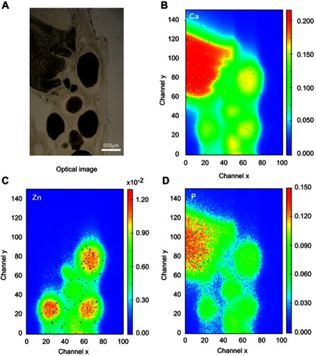 Figure 11 Zn-cHA microspheres implanted for 6 months in rat calvaria (region 2): (A) Optical image and (B–D) Ca, Zn and P SR-µXRF elemental mapping.Abbreviations: Zn-cHA, Zn-doped carbonated hydroxyapatite; SR-µXRF, Synchrotron radiation-based X-ray microfluorescence.